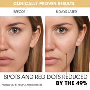 Gel with Vita C Caps