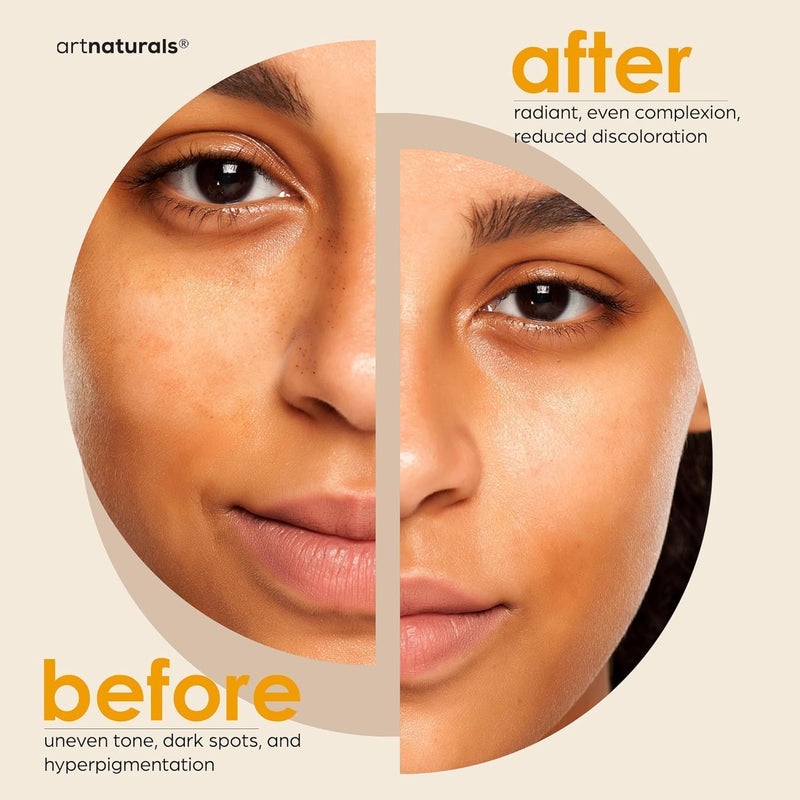 Kojic Acid Brightening Soap + African Exfoliating Net – Fade Dark Spots, Acne Scars & Uneven Skin Tone